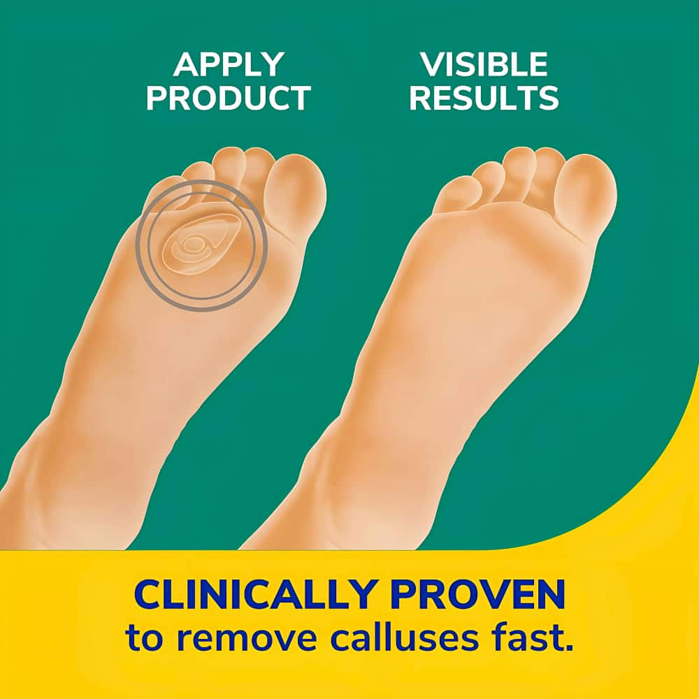 Dr. Scholl's Callus Removers - 6s