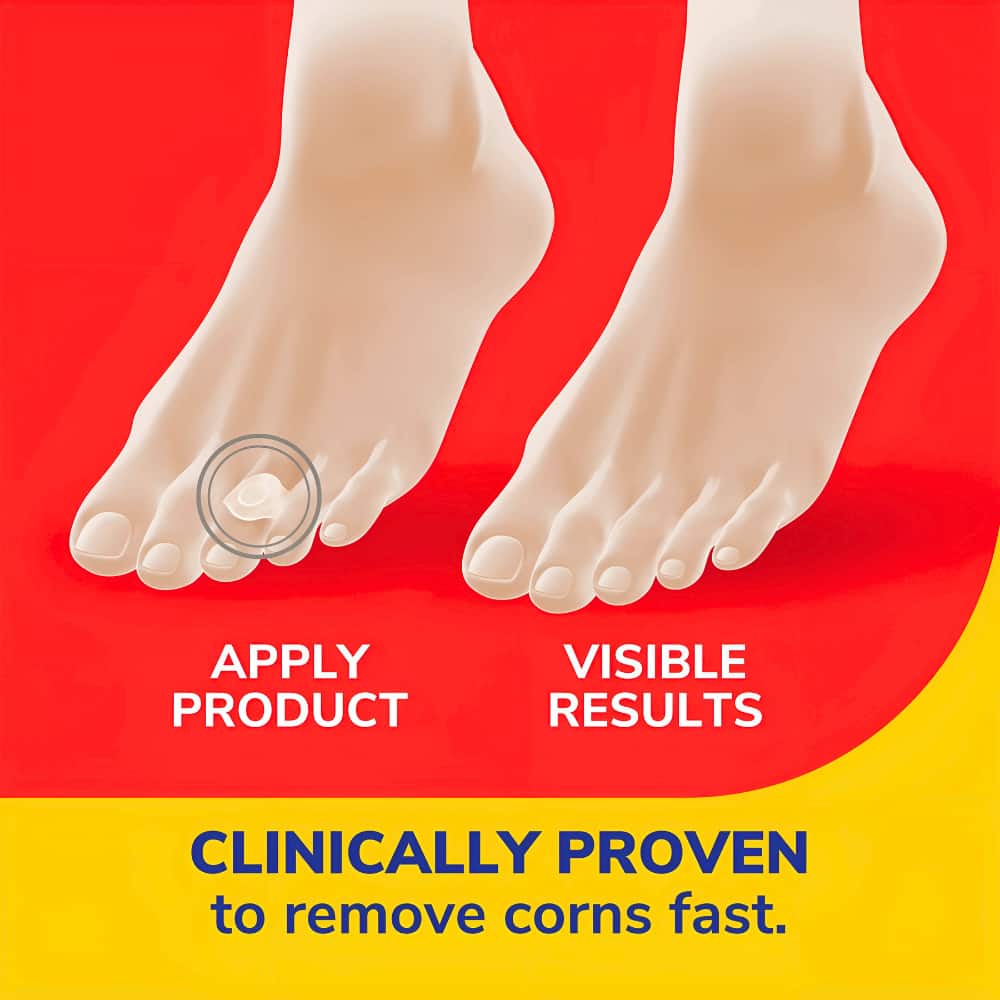 Dr. Scholl's Corn Removers - 6s