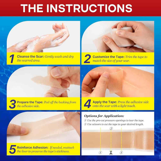 Medical silicone scar tape
