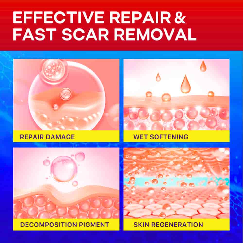 Reusable silicone scar tape