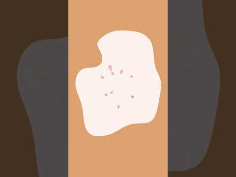 Drive Series Bariatric Forearm Crutches