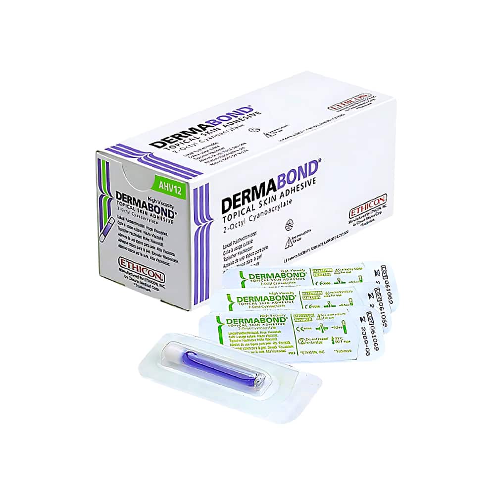 topical adhesive for minor wounds