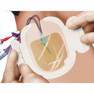 Tegaderm Chg Iv Securement Dressing, Size 8.5cm X 11.5cm - Box Of 25