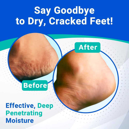 Dermal Therapy Heel Care Cream, Deep Penetrating, Actively Restores Moisture, 90 gram