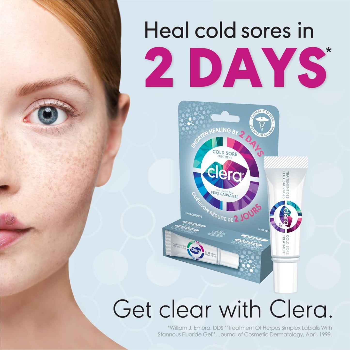 Clera Cold Sore Treatment Cream, Clinically Proven to Heal in 2 Days* - 2 Pack