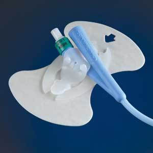 Ea/1 Foley Anchor Urinary Cath Securement