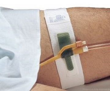Catheter Leg Strap with Locking Tabs, Latex Free