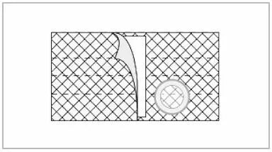 Ea/1 Nu-Form Cool Comfort 7In, Xlarge, 2 3/8In Left Side Opening, W/Prolapse Overbelt (Non-Returnable)