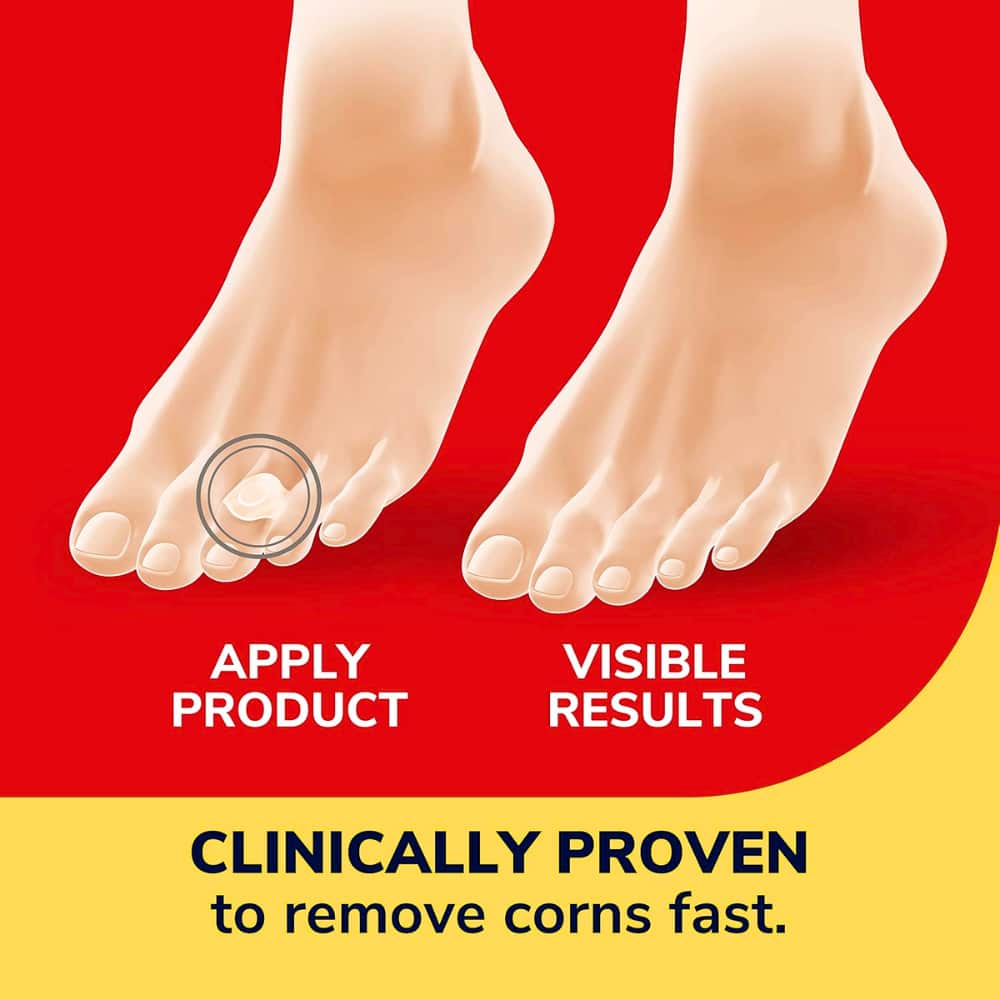 discreet corn treatment