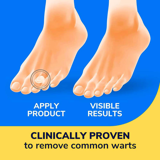 promotes natural tissue replacement